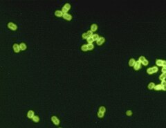 Pneumococcus CDC PHIL ID1003.jpg