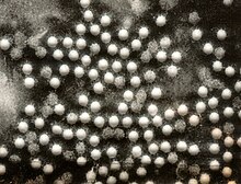"Poliovírus" elektronmikroszkópos felvétele