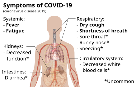 Fail:Symptoms of coronavirus disease 2019.svg