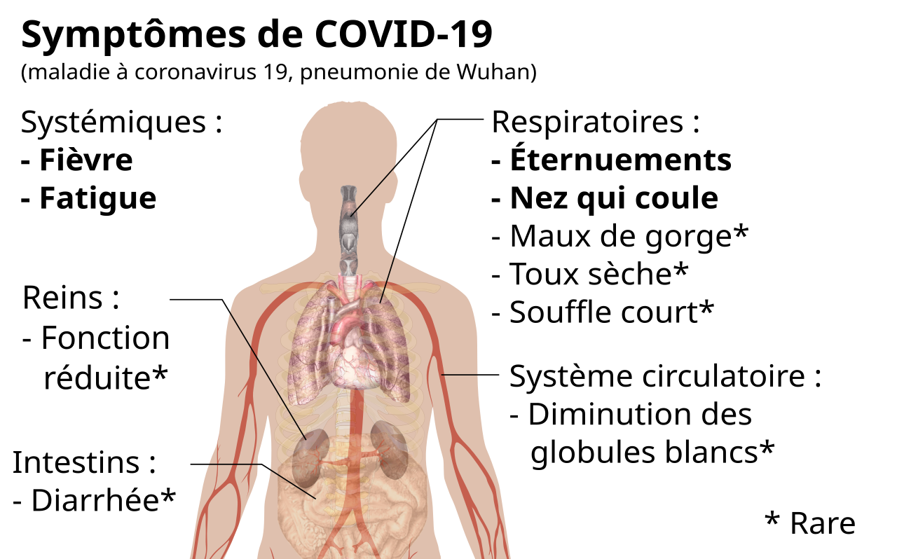 Description de l'image Symptoms of coronavirus disease 2019.svg.