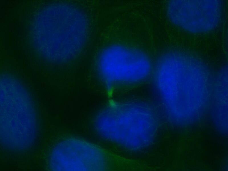 File:Chromatin bridges viewed using immunofluorescence.tiff