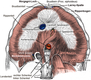 <span class="mw-page-title-main">Bochdalek hernia</span> Medical condition