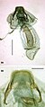 Ectoedemia algeriensis female genitalia.JPG