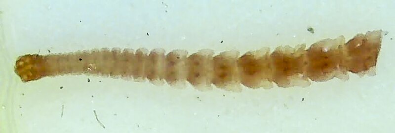 File:Hymenolepis scolex and first segments1.jpg