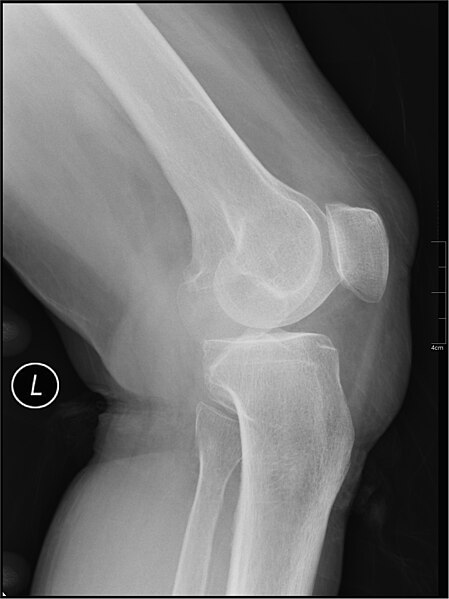 File:Medical X-Ray imaging COL03 nevit.jpg