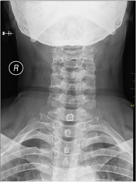 File:Medical X-Ray imaging IBO05 nevit.jpg