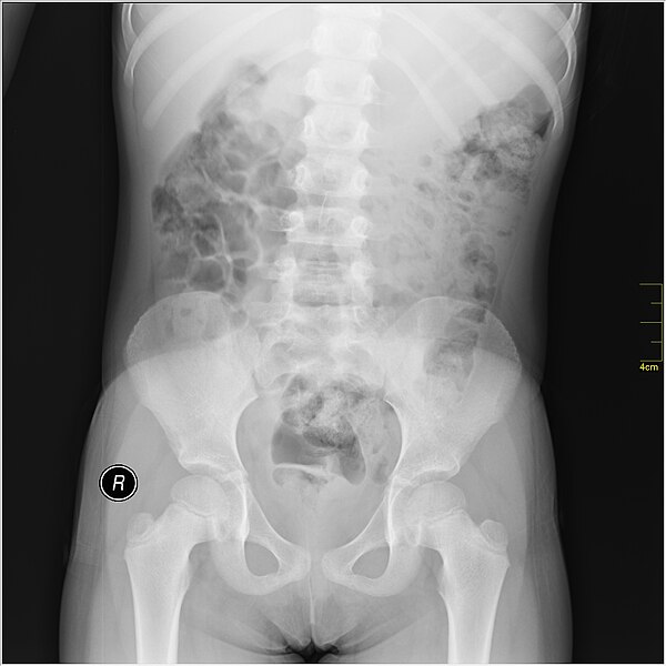 File:Medical X-Ray imaging TOR07 nevit.jpg