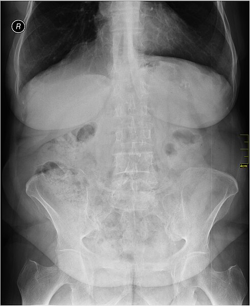 File:Medical X-Ray imaging VNK07 nevit.jpg