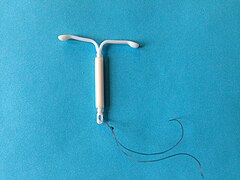 Mirena IUD.jpg