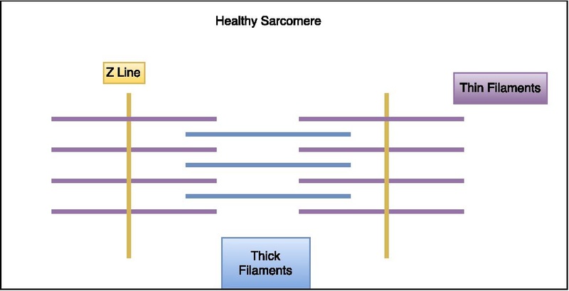 File:Normal Sarcomere.pdf