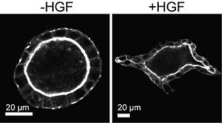 Branching morphogenesis in 3D cell culture.jpg