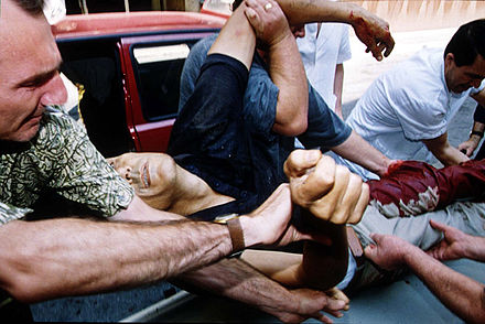 A victim of a mortar attack delivered to a Sarajevo hospital in 1992