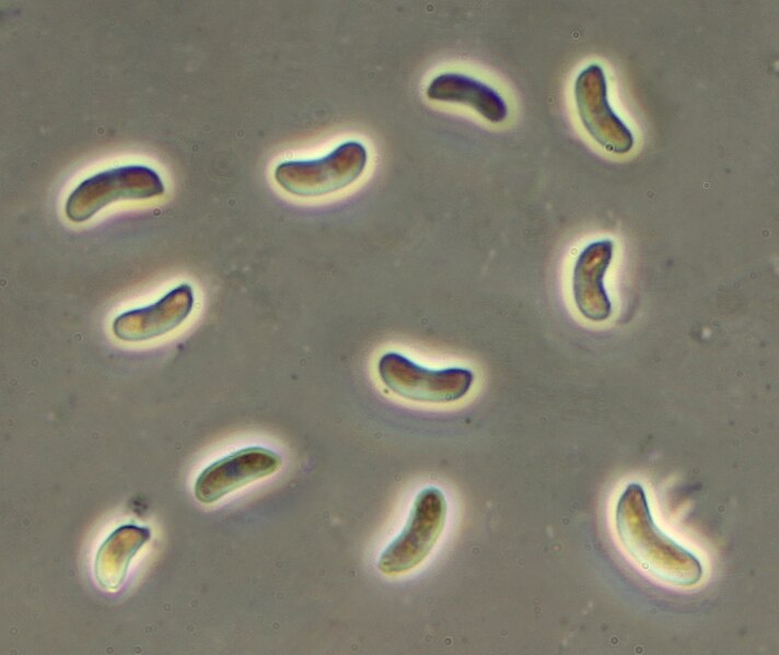 File:Exidia glandulosa spores 400x.JPG