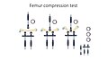Femur compression test