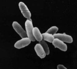Halobacteria sp. strain NRC-1, kila seli ina urefu wa µm 5