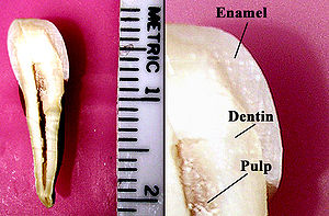 Tooth Enamel