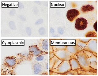 <span class="mw-page-title-main">Immunohistochemistry</span> Common application of immunostaining