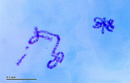 Fail:Polytene chromosomes (248 30) Salivary glands of nonbiting midges larvae (Chironomidae).jpg