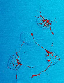 Zdjęcie mikroskopowe mysich neuronów pokazujące czerwone zabarwione wtrącenia zidentyfikowane jako białko prionowe scrapies.