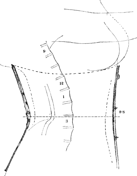 File:Uber den Einfluss des Korsetts auf die somatischen VerhaltnissFig31.png