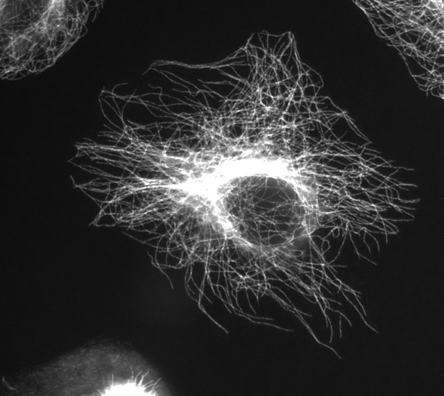 Microtubules in a gel-fixated cell