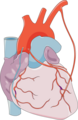 Coronary Artery Bypass Grafting 22
