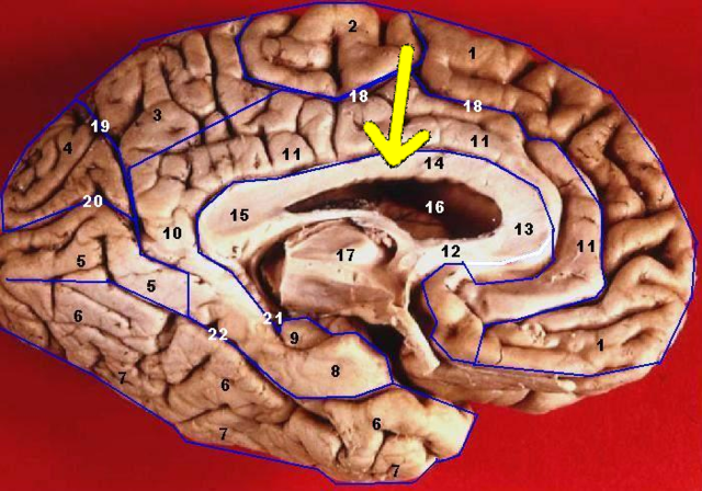 brain diagram corpus callosum