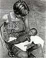 IVS Nutritionist Marian Cast with a Malnourished Child in Papua NewGuinea, 1978 (13875616563).jpg