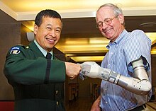 Dr. Ling doing the fist bump with an artificial arm patient. LingFistBumpArtificialArm.jpg