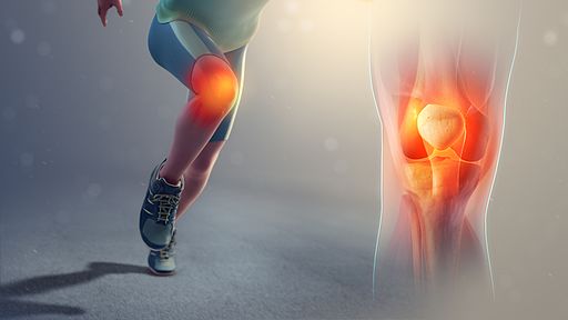 If your knee hurts when doing lunges, it may be due to poor kneecap tracking.