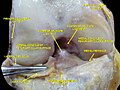 Anterior view of knee