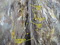 Spinal cord. Spinal membranes and nerve roots.Deep dissection. Posterior view.