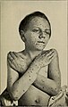 The health-care of the growing child; (1919) (14594660478).jpg