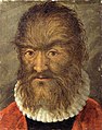 (Hairy Man from Munich, 1580s).  Schloss Ambras, Innsbruck.