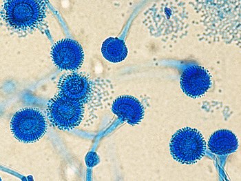 Aspergillus fumigatus Azienda Ospedaliera SS. Antonio e Biagio e Cesare Arrigo, Alessandria 21.8 5.000 out of 10, SD 2.132