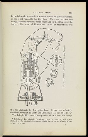 File:Artificial left leg, London, England Wellcome L0057950.jpg - Wikimedia  Commons