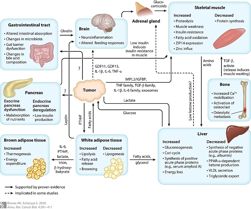 Krebsassoziiertes Kachexiediagramm