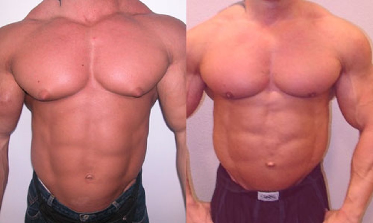 какими упражнениями убрать жир на груди у мужчин фото 10
