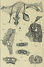 Thumbnail for File:Hermaphroditismus beim Menschen (1908) (14760760926).jpg