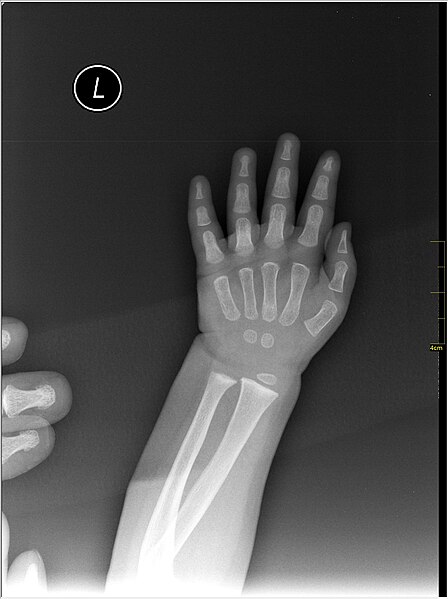 File:Medical X-Ray imaging RNB07 nevit.jpg