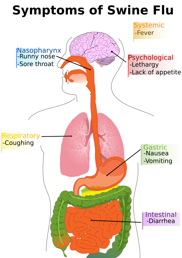 File:PD Diagram of swine flu symptoms EN.svg - Wikimedia Commons