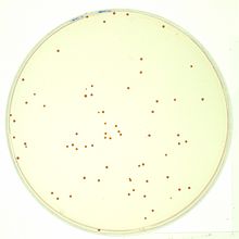 Cell counting - Wikipedia