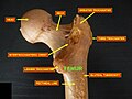 Femoral neck. Posterior view.