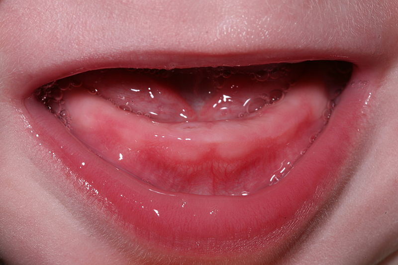 File:Teething.jpg