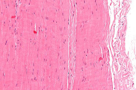 Плотная оформленная ткань сухожилия. Fibrous connective Tissue. Сухожилие микрофотография. Сухожилие препарат.