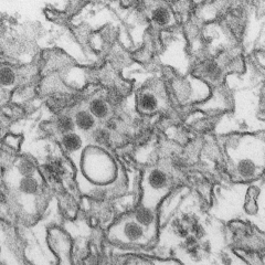 vírus zika pod elektrónovým mikroskopom