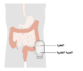 Diagram showing a colostomy with a bag CRUK 061-ar.png