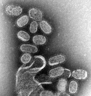 A transmission electron micrograph (TEM) of the reconstructed 1918 pandemic influenza virus. The bottom structure represents membrane debris from the cells used to amplify the virus.[21] Pictured are the 'elliptical' particles representing the smallest particles produced by influenza virus. Purification techniques often deform the particles without proper fixation protocols, leading to 'spherical' appearance.[12] (Filamentous or intermediate sized particles simply extend along the long axis on the opposite side of the genome segments.)