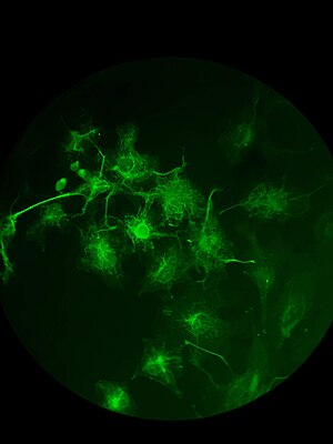 Células vistas através de um microscópio de fluorescência que permite ver uma determinada proteína em verde.