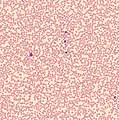 Howell-Jolly bodies (Overview of peripheral blood stain, May-Grünwald Giemsa).jpg